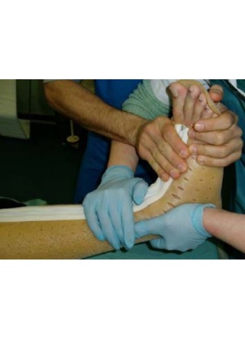 Immobilizzatore di piede,...