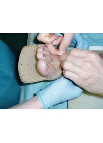 Immobilizzatore di piede,... 2