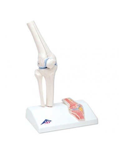 Mini articolazione del ginocchio con sezione trasversale, su base A85/1