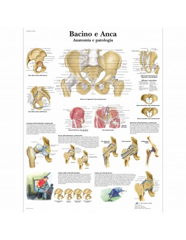 3B Scientific, tavola anatomica, Bacino e Anca - Anatomia e patologia (cod, VR4172UU)