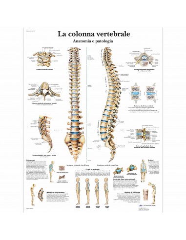 3B Scientific, tavola anatomica, La colonna vertebrale, anatomia e patologia (cod, VR4152UU)