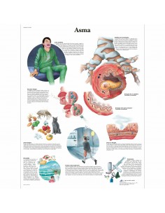 3B Scientific, tavola anatomica laminata Asma (cod, VR4328L)