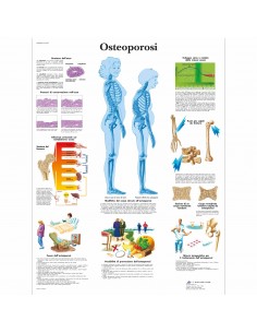 3B Scientific, tavola anatomica, Poster Osteoporosi (cod. VR4121UU)