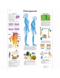 3B Scientific tavola anatomica Poster Osteoporosi cod VR4121L