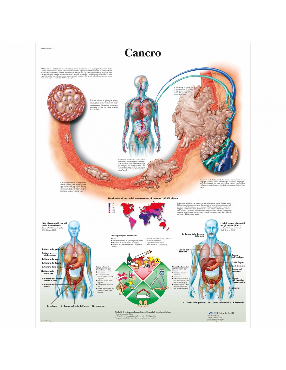 3B Scientific tavola anatomica Poster Cancro cod VR4753L