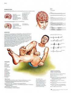3B Scientific, tavola anatomica, Poster Epilessia cod. VR4626UU