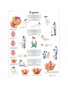 3B Scientific, tavola anatomica, Il Parto (cod, VR4555L)