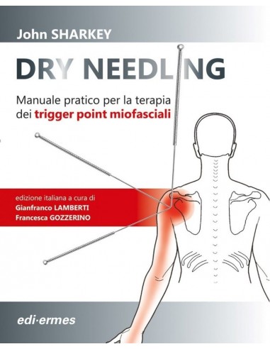 Dry Needling - Manuale pratico per la...