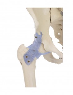 Erler Zimmer, modello... 2