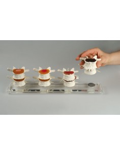 Erler Zimmer, modello... 2