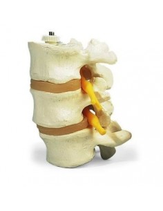 3 vertebre lombari, 3B Scientific, montaggio elastico A76/8