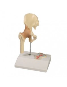 Erler Zimmer, modellino anatomico di articolazione dell'anca, con sezione trasversale 4523