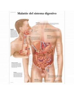 3B Scientific, tavola anatomica, Malattie del sistema digestivo (cod, VR4431UU)