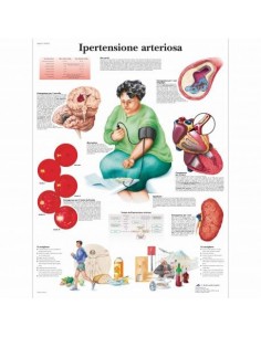 3B Scientific, tavola anatomica, Ipertensione Arteriosa (cod, VR4361UU)